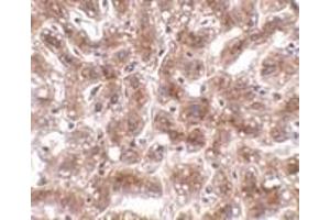 Immunohistochemistry of CUEDC1 in human liver tissue with CUEDC1 antibody at 2 μg/ml. (CUEDC1 antibody  (C-Term))