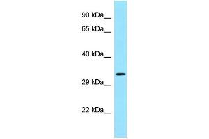 WB Suggested Anti-FGFR1OP2 Antibody Titration: 1.