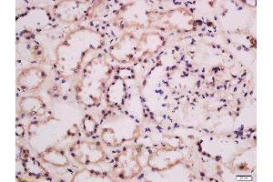 Formalin-fixed and paraffin embedded human kidney labeled with Anti-GRB10/14 Polyclonal Antibody, Unconjugated  at 1:100 followed by conjugation to the secondary antibody and DAB staining. (GRB10/14 (AA 501-594) antibody)