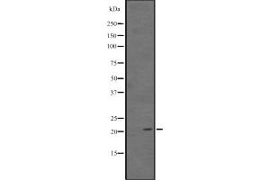 Western blot analysis of ARL11 expression in Human kidney tissue lysate ,The lane on the left is treated with the antigen-specific peptide. (ARL11 antibody  (Internal Region))