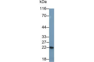 Detection of CRP in Porcine Plasma using Polyclonal Antibody to C Reactive Protein (CRP) (CRP antibody  (AA 20-222))