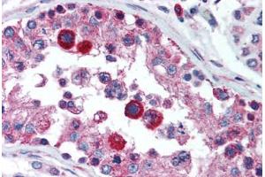 Human Testis (formalin-fixed, paraffin-embedded) stained with HAVCR1 antibody ABIN292373 at 5 ug/ml followed by biotinylated goat anti-rabbit IgG secondary antibody ABIN481713, alkaline phosphatase-streptavidin and chromogen. (HAVCR1 antibody  (N-Term))