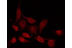 ABIN6267617 staining NIH-3T3 by IF/ICC. (PKC delta antibody  (pSer645))