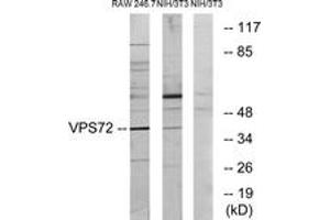 Western blot analysis of extracts from RAW264. (VPS72 antibody  (AA 131-180))