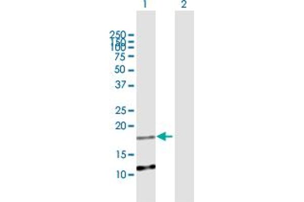 ATRAID antibody  (AA 1-171)