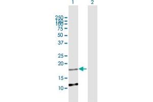 Western Blot analysis of C2orf28 expression in transfected 293T cell line by C2orf28 MaxPab polyclonal antibody.