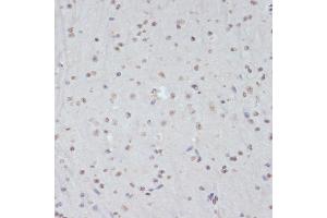Immunohistochemistry of paraffin-embedded mouse brain using Phospho-CDK1-Y15 antibody (ABIN3019442, ABIN3019443, ABIN3019444 and ABIN6225371) at dilution of 1:100 (40x lens). (CDK1 antibody  (pTyr15))
