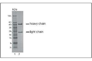 SDS-PAGE analysis of purified KH-4F5 monoclonal antibody. (CCR4 antibody)
