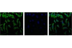 IF analysis of Hela with antibody (Left) and DAPI (Right) diluted at 1:100. (EIF4A1 antibody)
