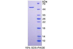 SDS-PAGE (SDS) image for Interleukin 28A (Interferon, lambda 2) (IL28A) (AA 26-200) protein (His tag,GST tag) (ABIN2123082) (IL28A Protein (AA 26-200) (His tag,GST tag))