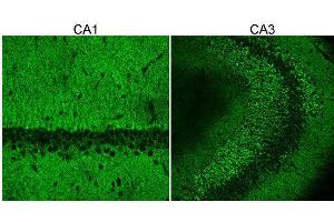 Bassoon antibody