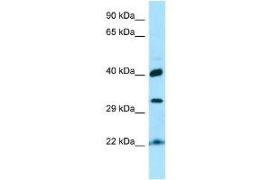 WB Suggested Anti-KTI12 Antibody Titration: 1. (KTI12 antibody  (C-Term))