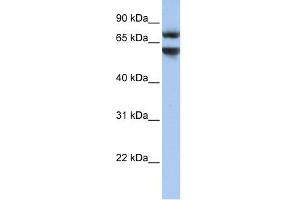 WB Suggested Anti-JPH3 Antibody Titration:  0.