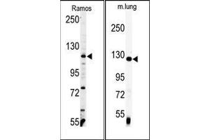(LEFT) Western blot analysis of anti-VINC Antibody (C-term) in Ramos cell line lysates (35ug/lane). (Vinculin antibody  (C-Term))