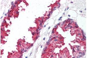 Human Prostate (formalin-fixed, paraffin-embedded) stained with BACE1 antibody ABIN213581 at 5 ug/ml followed by biotinylated goat anti-rabbit IgG secondary antibody ABIN481713, alkaline phosphatase-streptavidin and chromogen. (BACE1 antibody  (C-Term))