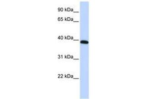 Image no. 1 for anti-Homeobox A10 (HOXA10) (AA 288-337) antibody (ABIN6744392)
