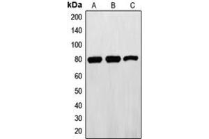 Western blot analysis of Ezrin expression in HeLa (A), A431 (B), SHSY5Y (C) whole cell lysates. (Ezrin antibody  (C-Term))