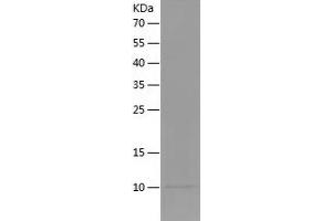 Western Blotting (WB) image for Insulin-Like Growth Factor 1 (IGF1) (AA 49-118) protein (His tag) (ABIN7123450) (IGF1 Protein (AA 49-118) (His tag))