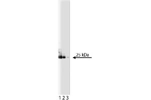 Western blot analysis of eIF-4E on a A431 lysate. (EIF4E antibody  (AA 1-217))