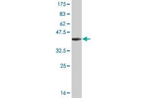 Western Blot detection against Immunogen (36. (KAT2B antibody  (AA 353-452))