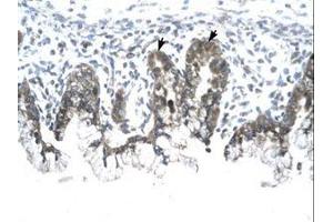 Image no. 1 for anti-Prohibitin (PHB) (AA 203-252) antibody (ABIN6735810) (Prohibitin antibody  (AA 203-252))