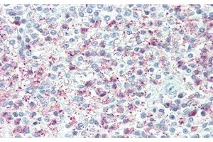 Detection of TNFaIP6 in Human Spleen Tissue using Polyclonal Antibody to Tumor Necrosis Factor Alpha Induced Protein 6 (TNFaIP6) (TNFAIP6 antibody  (AA 18-275))