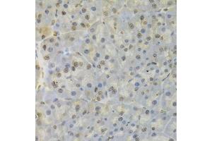 Immunohistochemistry (Paraffin-embedded Sections) (IHC (p)) image for anti-Heterogeneous Nuclear Ribonucleoprotein D (HNRNPD) (AA 1-306) antibody (ABIN6141905)