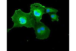 Anti-DFFA mouse monoclonal antibody (ABIN2452370) immunofluorescent staining of COS7 cells transiently transfected by pCMV6-ENTRY DFFA (RC202879). (DFFA antibody)