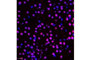 ZFP106 antibody