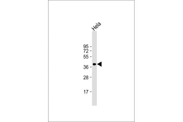 ARPC1B antibody  (AA 159-188)