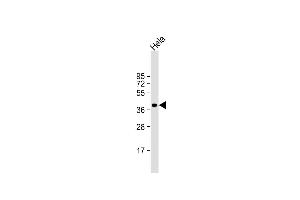 Anti-ARPC1B Antibody (Center) at 1:1000 dilution + Hela whole cell lysate Lysates/proteins at 20 μg per lane.