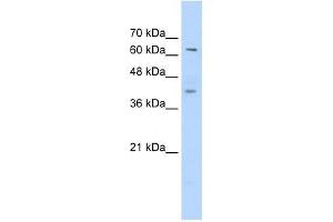 Western Blot showing ZNF415 antibody used at a concentration of 1-2 ug/ml to detect its target protein. (ZNF415 antibody  (C-Term))