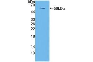 Detection of Recombinant TMEM27, Mouse using Polyclonal Antibody to Transmembrane Protein 27 (TMEM27) (TMEM27 antibody  (AA 12-222))
