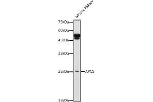 Western Blotting (WB) image for anti-Amyloid P Component, Serum (APCS) (AA 1-223) antibody (ABIN3022714)