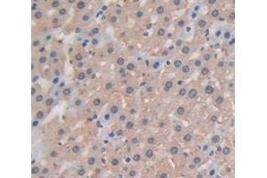 IHC-P analysis of Rat Tissue, with DAB staining. (GAA antibody  (AA 782-953))
