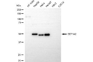 Western blotting analysis using EEF1A2 antibody (ABIN7798499). (Recombinant EEF1A2 antibody)