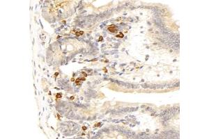 Immunohistochemistry analysis of paraffin-embedded mouse duodenum using,STC (ABIN7075723) at dilution of 1: 800 (Stanniocalcin 1 antibody)