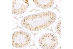 Immunohistochemistry analysis of paraffin-embedded rat testis using,ACRBP (ABIN7072890) at dilution of 1: 8000 (ACRBP antibody)