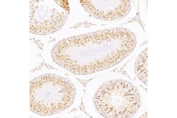 ACRBP antibody