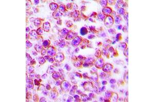 Immunohistochemical analysis of Claudin 2 staining in human tonsil formalin fixed paraffin embedded tissue section. (Claudin 2 antibody  (C-Term))