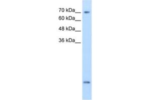 Western Blotting (WB) image for anti-Solute Carrier Family 6 (Neurotransmitter Transporter, Creatine), Member 8 (SLC6A8) antibody (ABIN2462555) (SLC6A8 antibody)