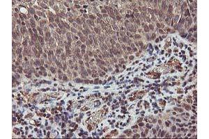 Image no. 4 for anti-V-Akt Murine Thymoma Viral Oncogene Homolog 1 (AKT1) antibody (ABIN1496554) (AKT1 antibody)