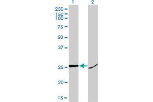 Western Blot analysis of HMGB1 expression in transfected 293T cell line by HMGB1 monoclonal antibody (M02), clone 1D5. (HMGB1 antibody  (AA 1-215))