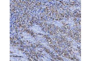 IHC analysis of Asparagine synthetase/ASNS using anti-Asparagine synthetase/ASNS antibody (ABIN7599465). (Asparagine Synthetase antibody  (AA 1-531))