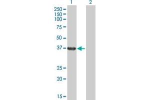 Western Blot analysis of RHOXF2 expression in transfected 293T cell line by RHOXF2 MaxPab polyclonal antibody. (RHOXF2 antibody  (AA 1-288))