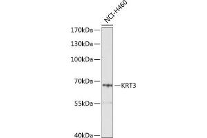 Western blot analysis of extracts of H460 cells, using KRT3 Antibody (ABIN6129539, ABIN6143027, ABIN6143028 and ABIN6214252) at 1:1000 dilution.