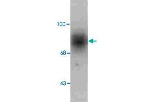 Western blot of human caudate lysate showing specific immunolabeling of the ~88k SLC6A3 protein. (SLC6A3 antibody  (C-Term))