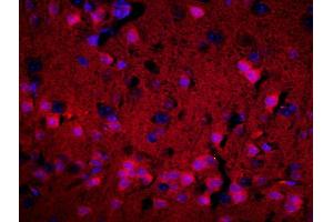 Formalin-fixed and paraffin-embedded rat brain labeled with Anti-ADORA1 Polyclonal Antibody, Unconjugatedused at 1:200 dilution for 40 minutes at 37°C. (ADORA1 antibody  (AA 225-326))