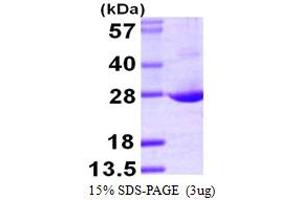 SDS-PAGE (SDS) image for Amino-terminal Enhancer of Split (AES) (AA 1-197) protein (His tag) (ABIN666634)