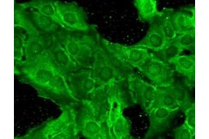 Immunocytochemistry/Immunofluorescence analysis using Mouse Anti-GluN2B/NR2B Monoclonal Antibody, Clone S59-36 (ABIN2483215). (GRIN2B antibody  (AA 20-271) (APC))
